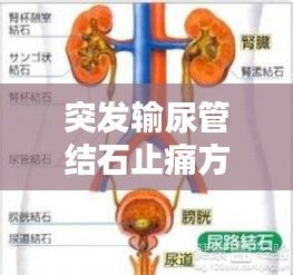 突發(fā)輸尿管結(jié)石止痛方法：輸尿管結(jié)石突發(fā)怎么辦 