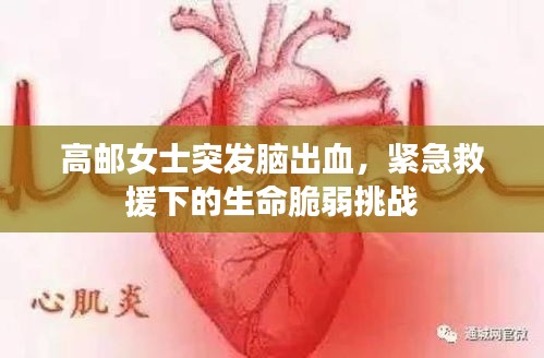 高郵女士突發腦出血，緊急救援下的生命脆弱挑戰